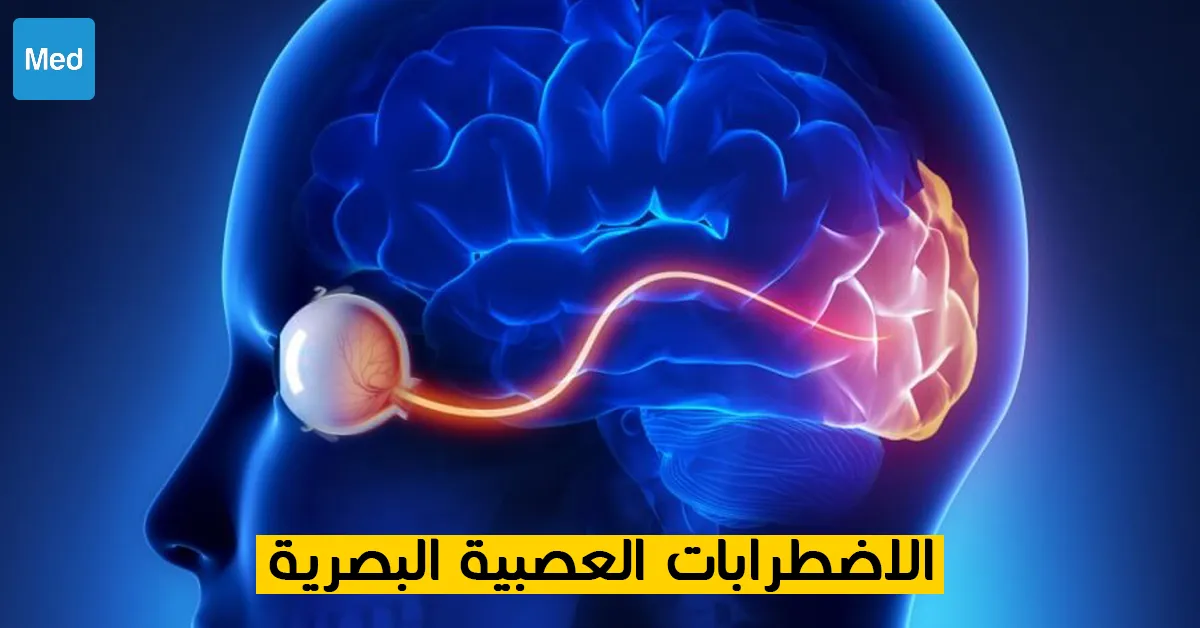 الاضطرابات العصبية البصرية 